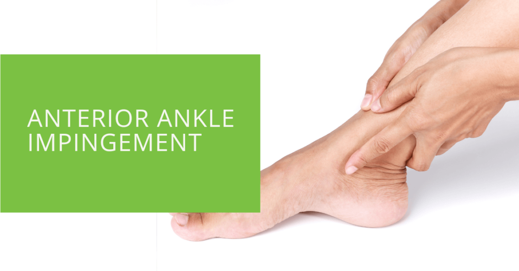 Understanding Anterior Ankle Impingement: Diagnosis and Treatment