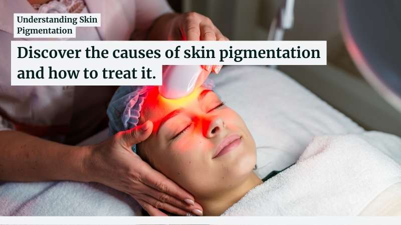 Face Pigmentation Types, Causes, Prevention and Treatment