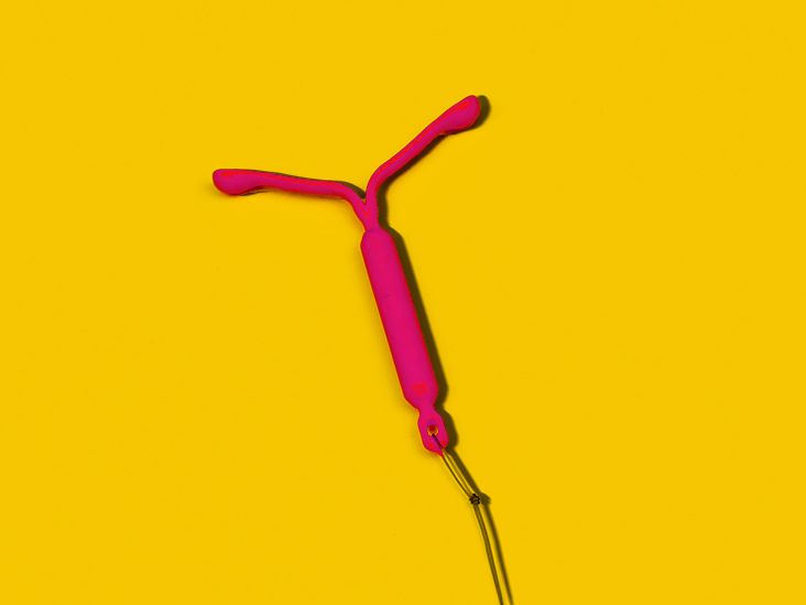 Copper IUD Pros and Cons