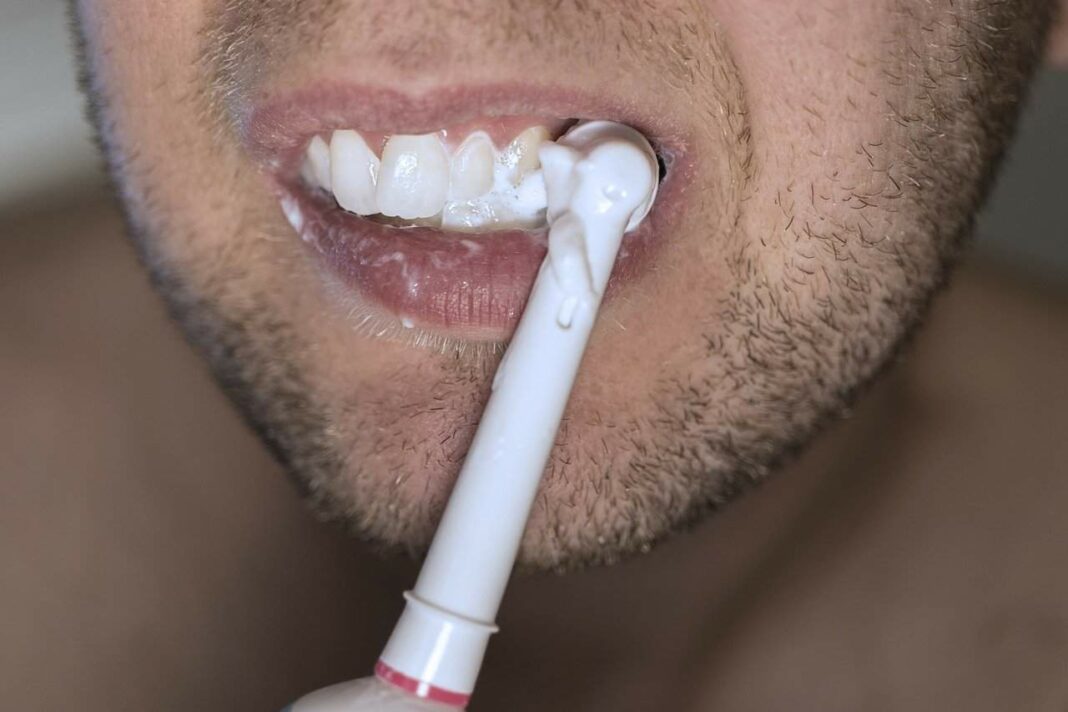 Teeth Whitening - Should You Do It?